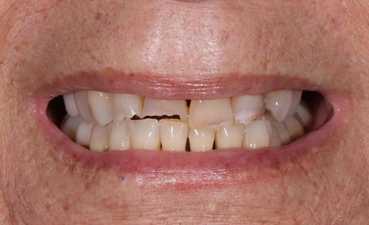 smile gallery image