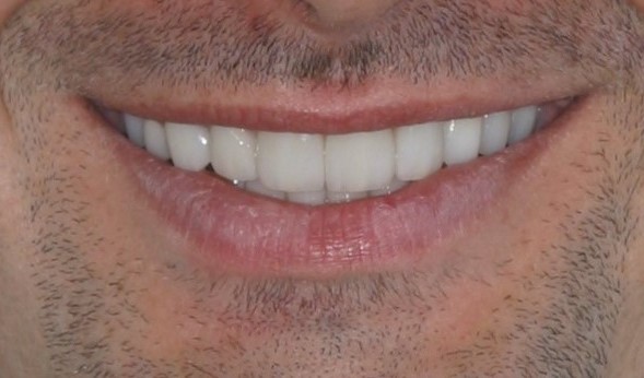 smile gallery image