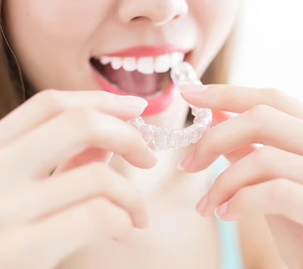 Alternative to Braces for Teens