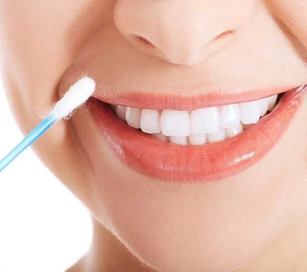 Oral DNA